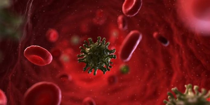 Neues Coronavirus-Symptom in Italien entdeckt